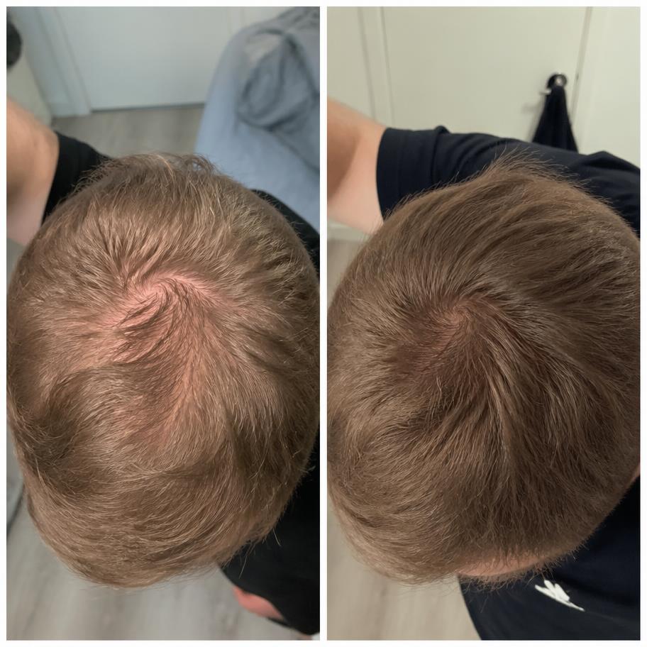Marcus — före och efter